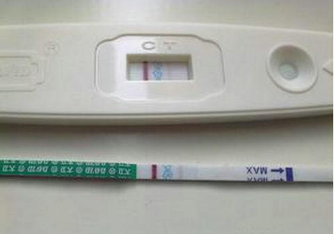 无精症案例